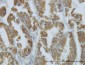 NODAL Antibody (monoclonal) (M03)